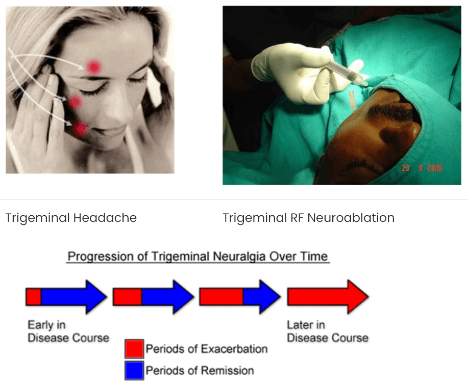 Slip Disc & Sciatica - Spine Disc & Pain Specialist - Dr. Neeraj Jain,  Ozone Disc Treatment