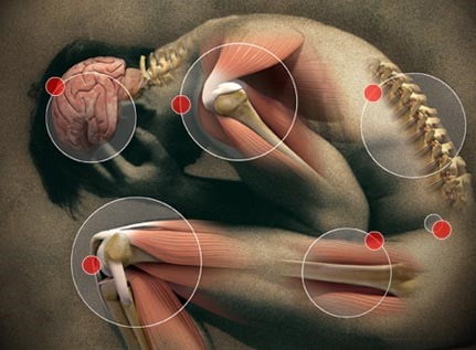 Slip Disc & Sciatica - Spine Disc & Pain Specialist - Dr. Neeraj Jain,  Ozone Disc Treatment